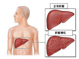 胎盘早剥会怎么样